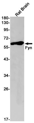 2 - FYN Rabbit mAb AP75464