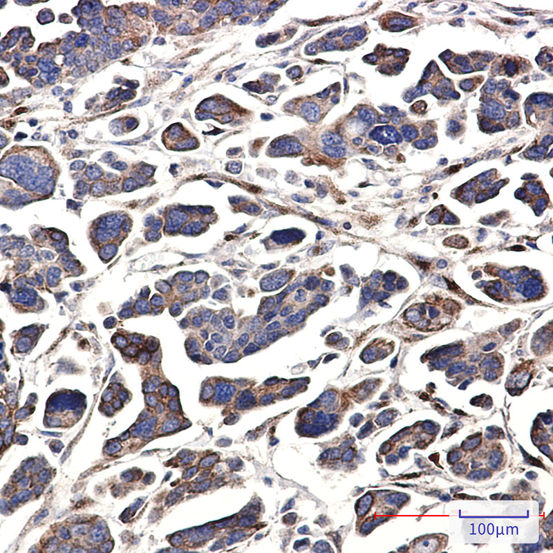 2 - GNA13 Rabbit mAb AP75466