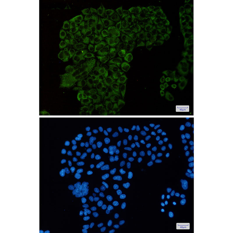 4 - [KD]G3BP Rabbit mAb AP75467