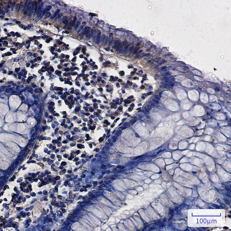 8 - [KD]G3BP Rabbit mAb AP75467