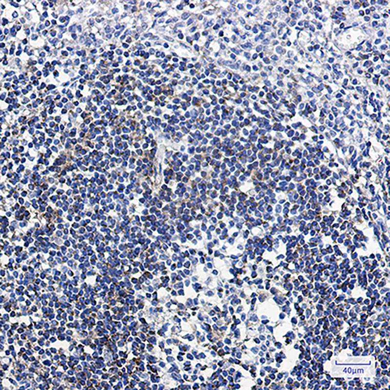 8 - ABAT Rabbit mAb AP75469