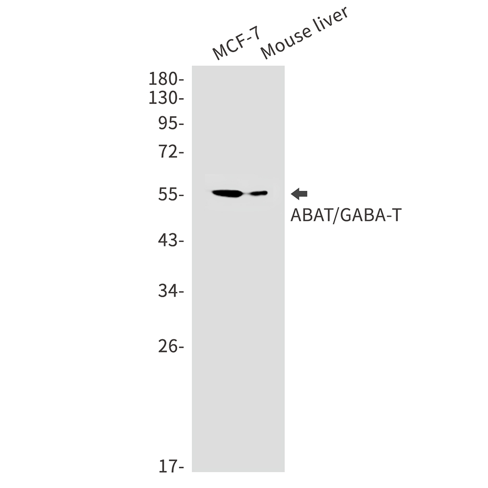 1 - ABAT Rabbit mAb AP75469
