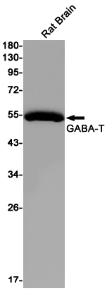 2 - ABAT Rabbit mAb AP75469