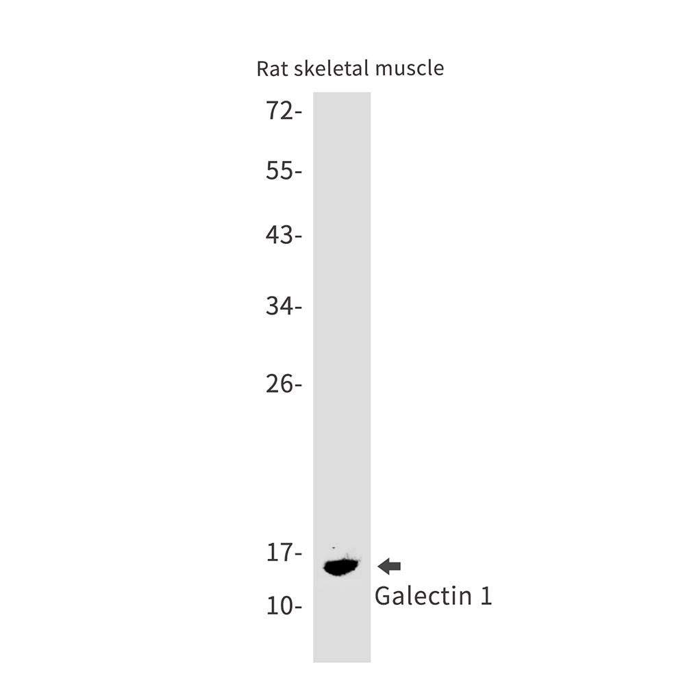 1 - Galectin 1 Rabbit mAb AP75471