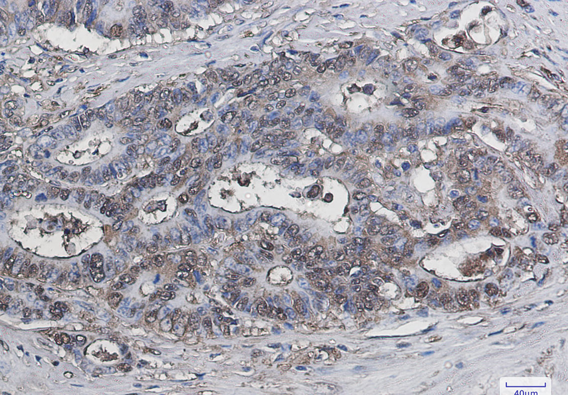 8 - Galectin 3 Rabbit mAb AP75472