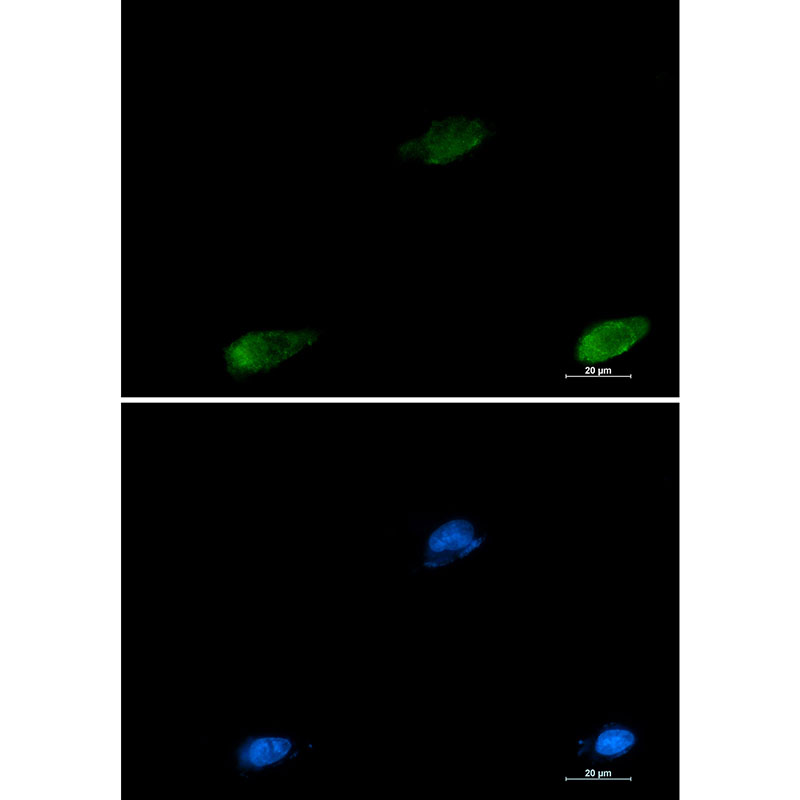 1 - Galectin 3 Rabbit mAb AP75473