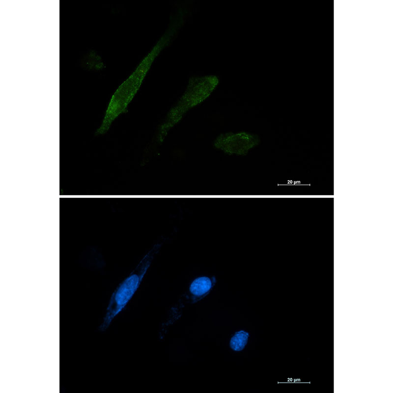 1 - Galectin 3 Rabbit mAb AP75474