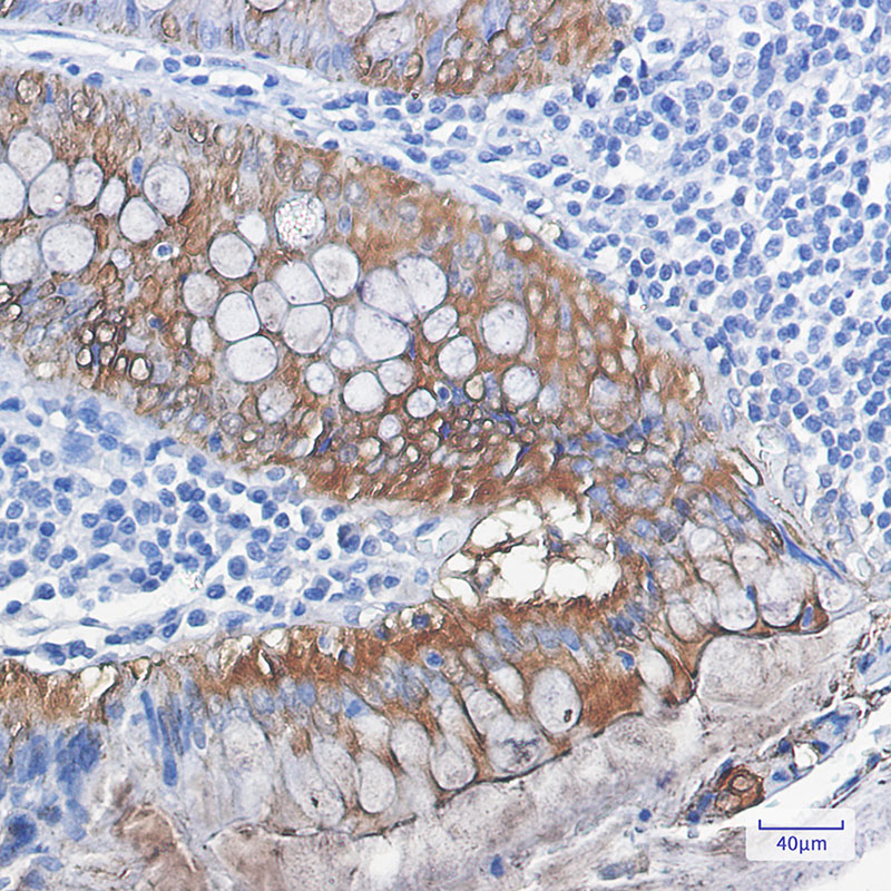 4 - Galectin 3 Rabbit mAb AP75474