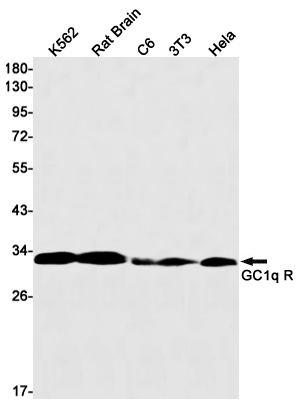1 - GC1q R Rabbit mAb AP75476