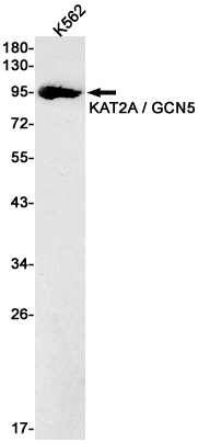 1 - KAT2A Rabbit mAb AP75480