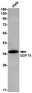 1 - GDF15 Rabbit mAb AP75481