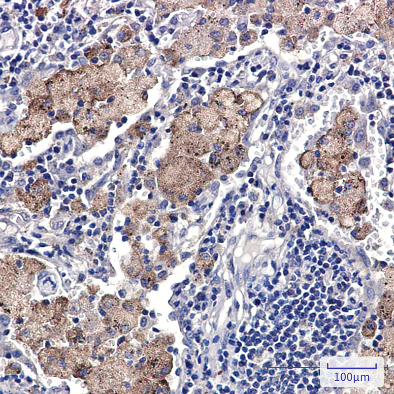 2 - SMN/Gemin 1 Rabbit mAb AP75484
