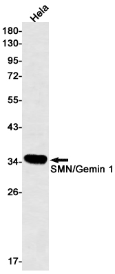 1 - SMN/Gemin 1 Rabbit mAb AP75484