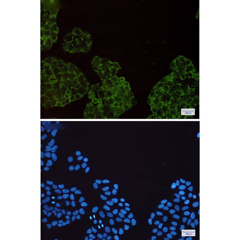 8 - SMN/Gemin 1 Rabbit mAb AP75485