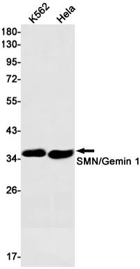 1 - SMN/Gemin 1 Rabbit mAb AP75485