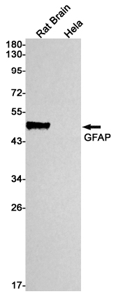 1 - GFAP Rabbit mAb AP75487