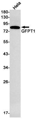 1 - GFPT1 Rabbit mAb AP75488