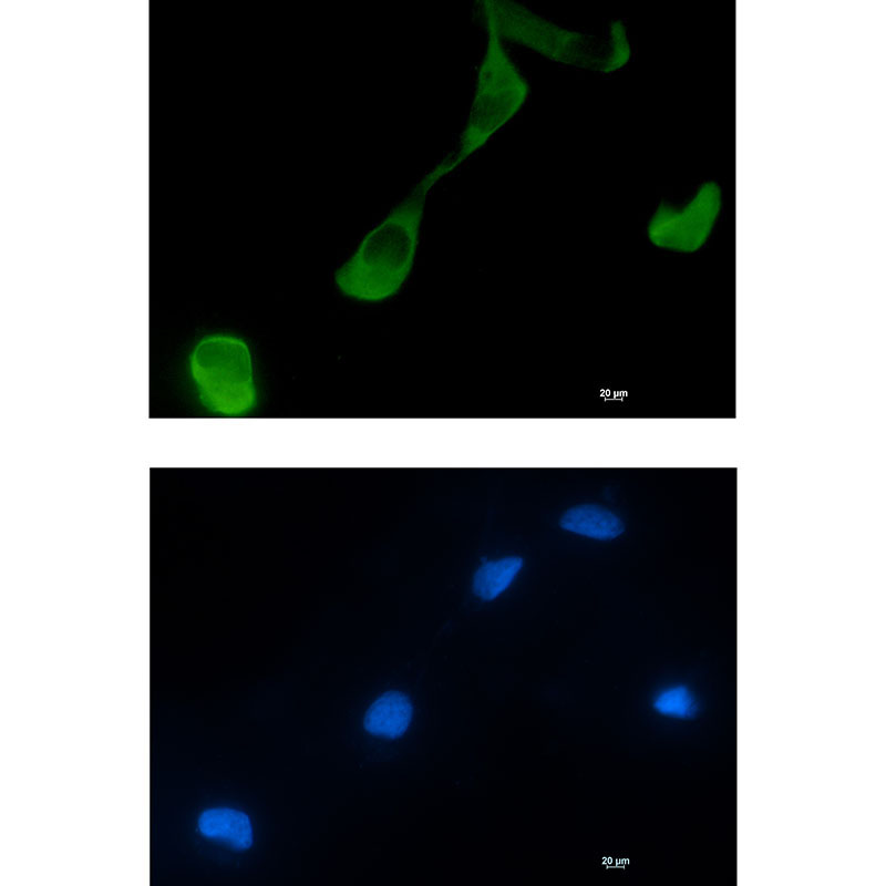 1 - GFPT2 Rabbit mAb AP75489