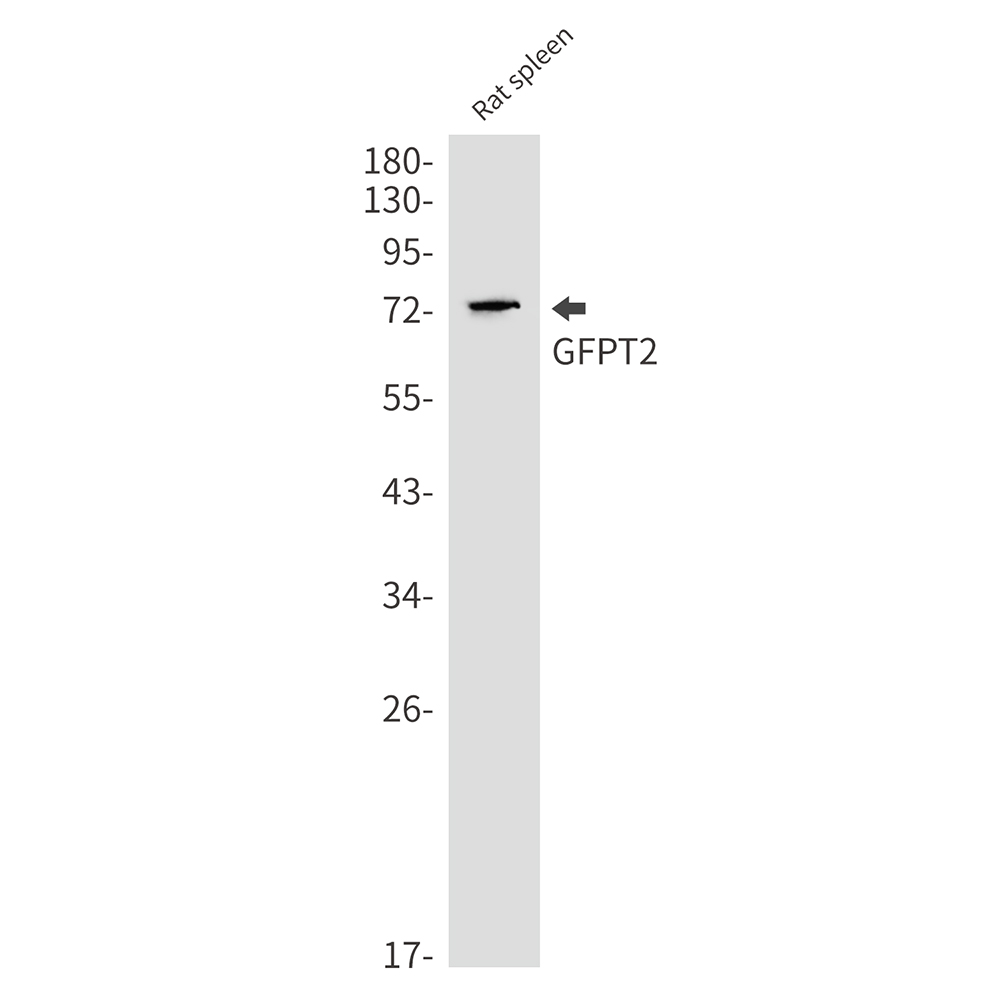 8 - GFPT2 Rabbit mAb AP75489
