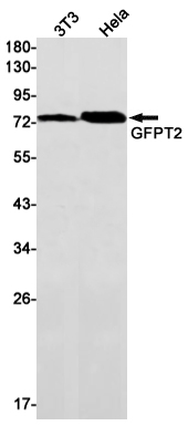 4 - GFPT2 Rabbit mAb AP75489