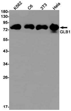 1 - GLB1/Beta-galactosidase Rabbit mAb AP75490