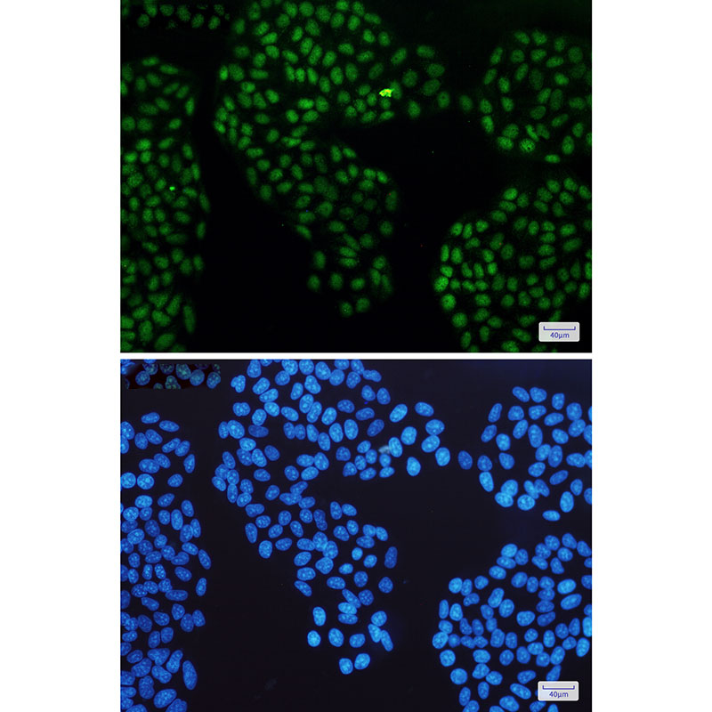 8 - Glucocorticoid Receptor Rabbit mAb AP75493