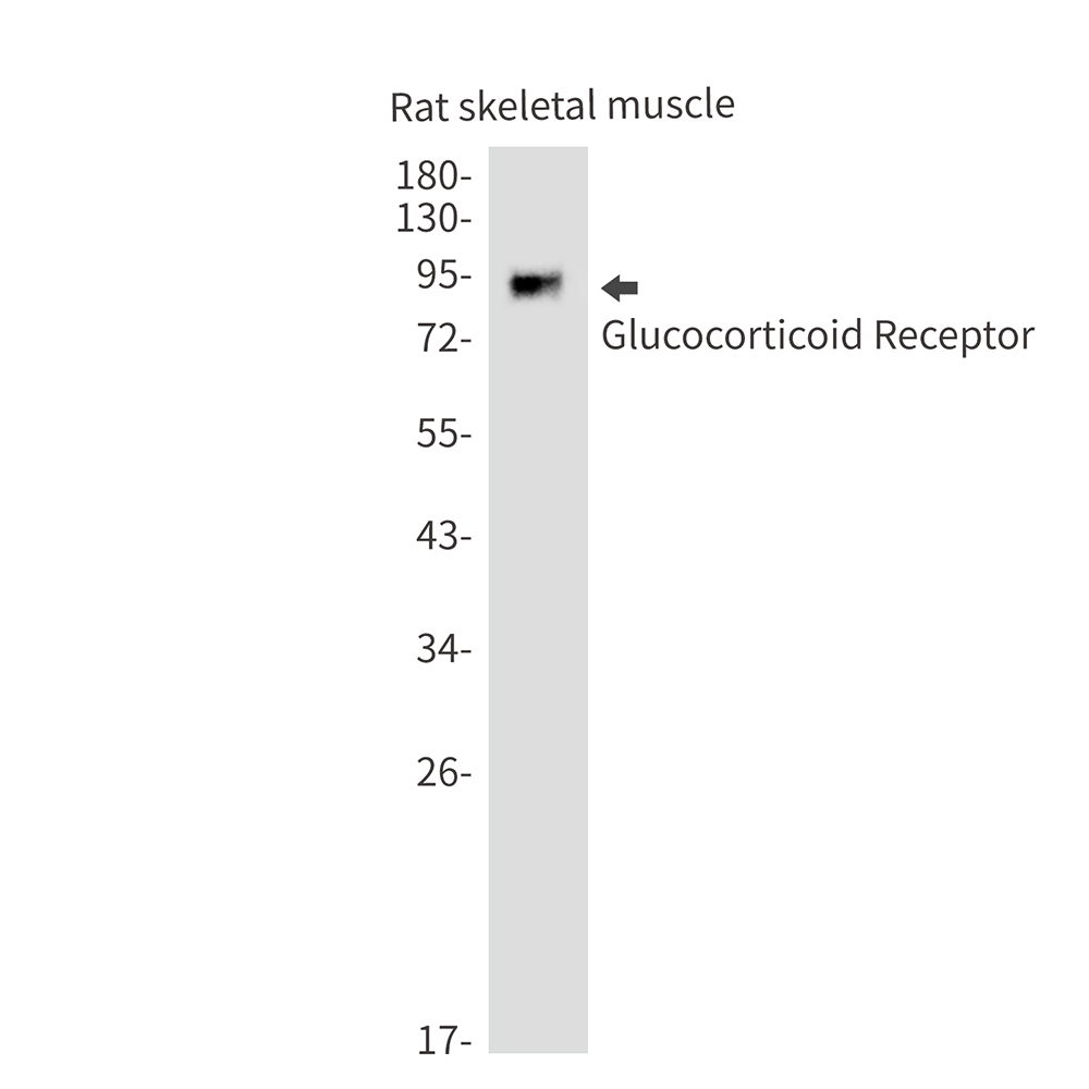 1 - Glucocorticoid Receptor Rabbit mAb AP75493