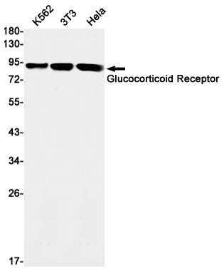 2 - Glucocorticoid Receptor Rabbit mAb AP75493