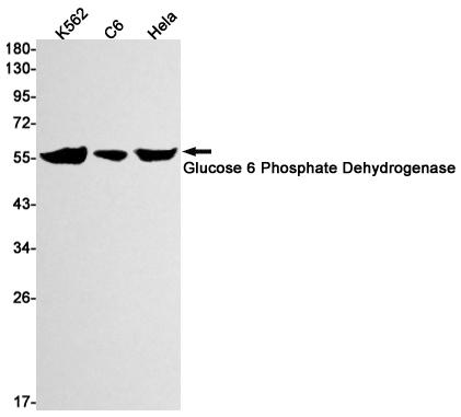 1 - Glucose 6 Phosphate Dehydrogenase Rabbit mAb AP75494