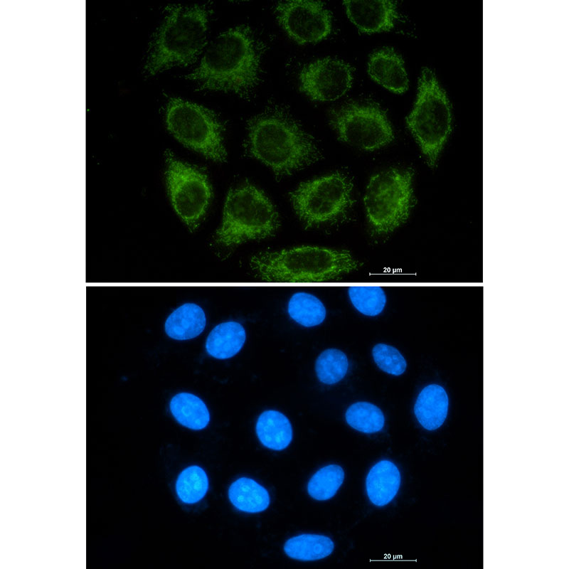 1 - Glutaminase Rabbit mAb AP75496