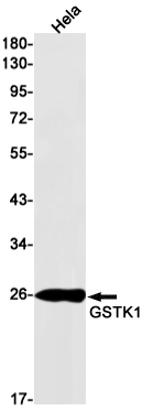 1 - [KD]GSTK1 Rabbit mAb AP75500