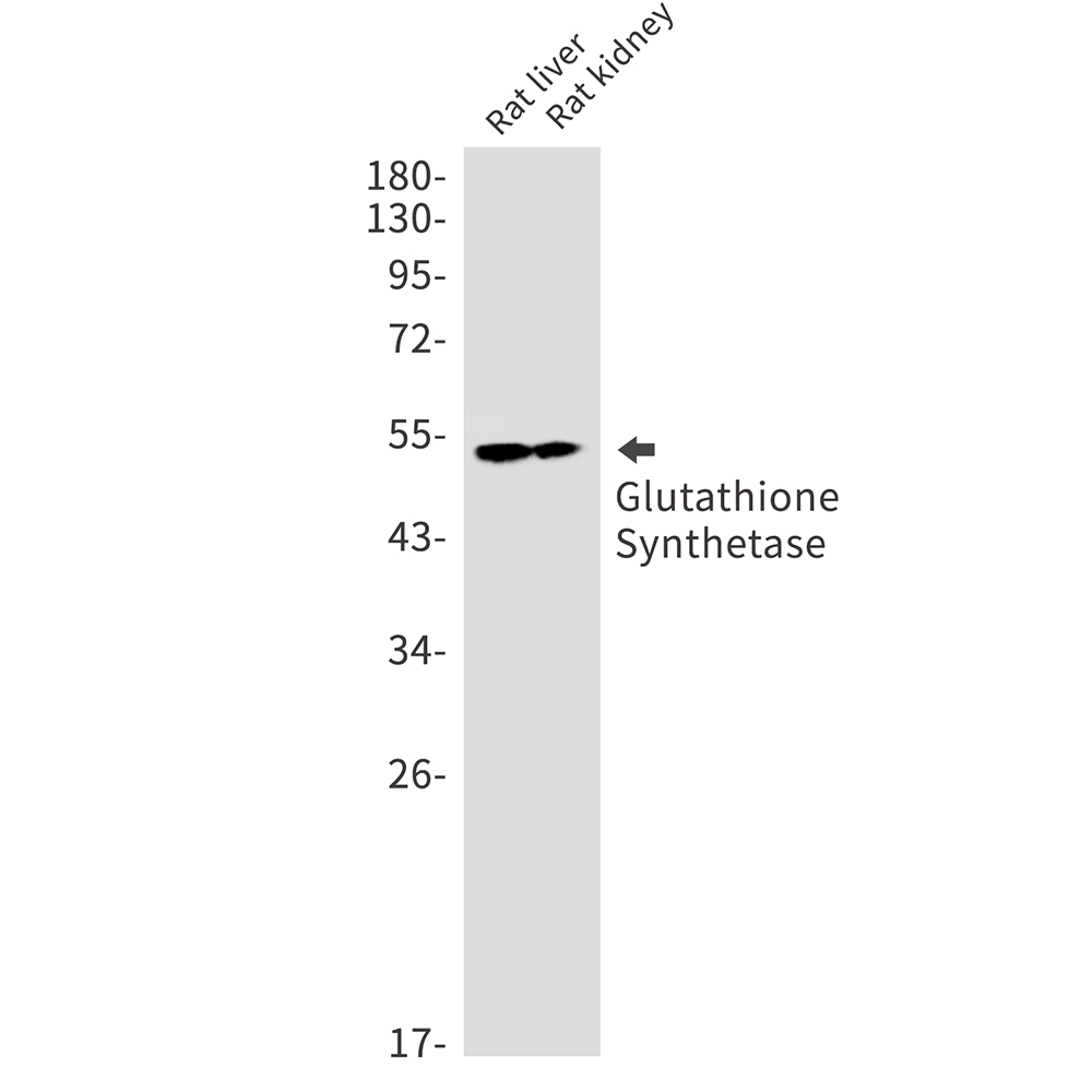 1 - Glutathione Synthetase Rabbit mAb AP75502