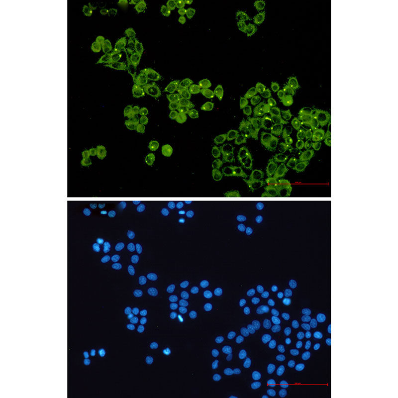 0 - Glycogen synthase 1/GYS1 Rabbit mAb AP75504