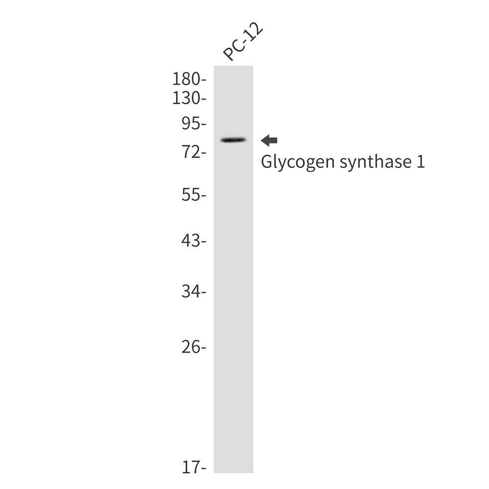 1 - Glycogen synthase 1/GYS1 Rabbit mAb AP75504