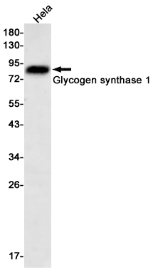 8 - Glycogen synthase 1/GYS1 Rabbit mAb AP75504
