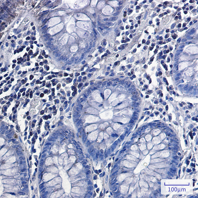 2 - Phospho-Glycogen synthase 1/GYS1(Ser641) Rabbit mAb AP75505