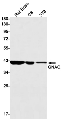 1 - GNAQ Rabbit mAb AP75507