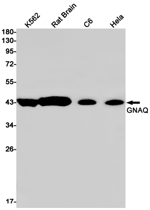 1 - GNAQ Rabbit mAb AP75508