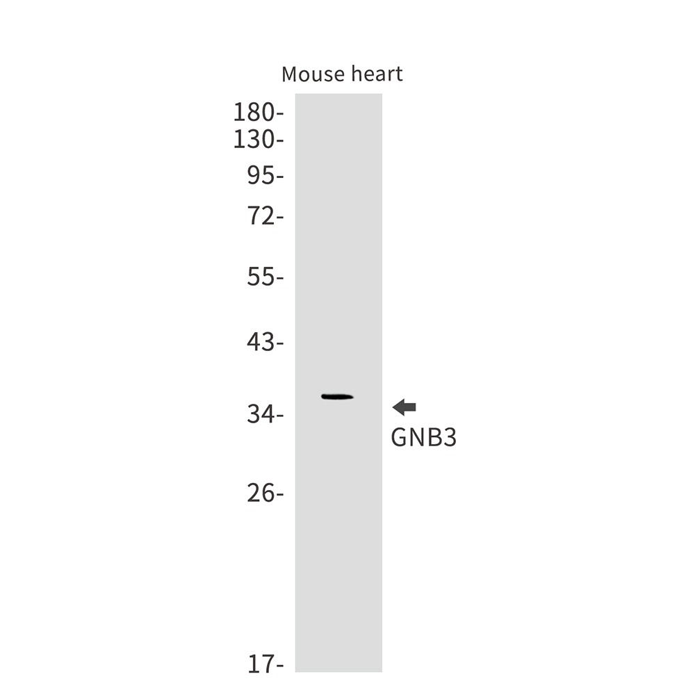 1 - GNB3 Rabbit mAb AP75510