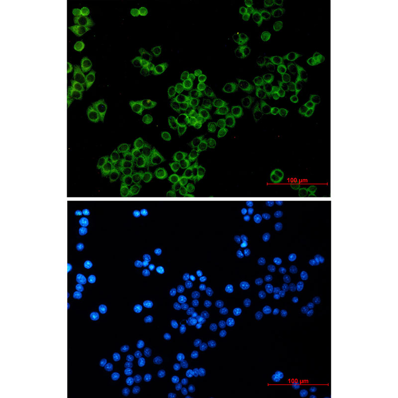 1 - LGR6 Rabbit mAb AP75513