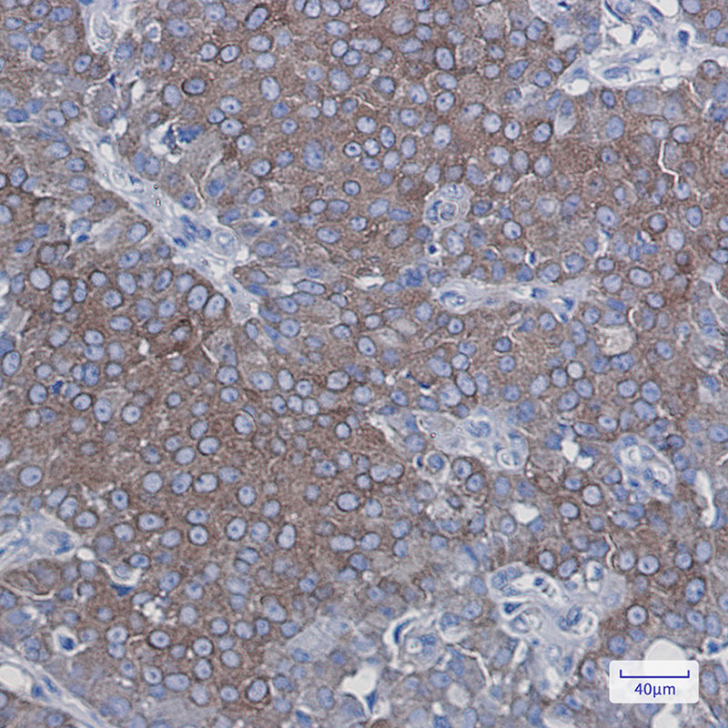 8 - LGR6 Rabbit mAb AP75513