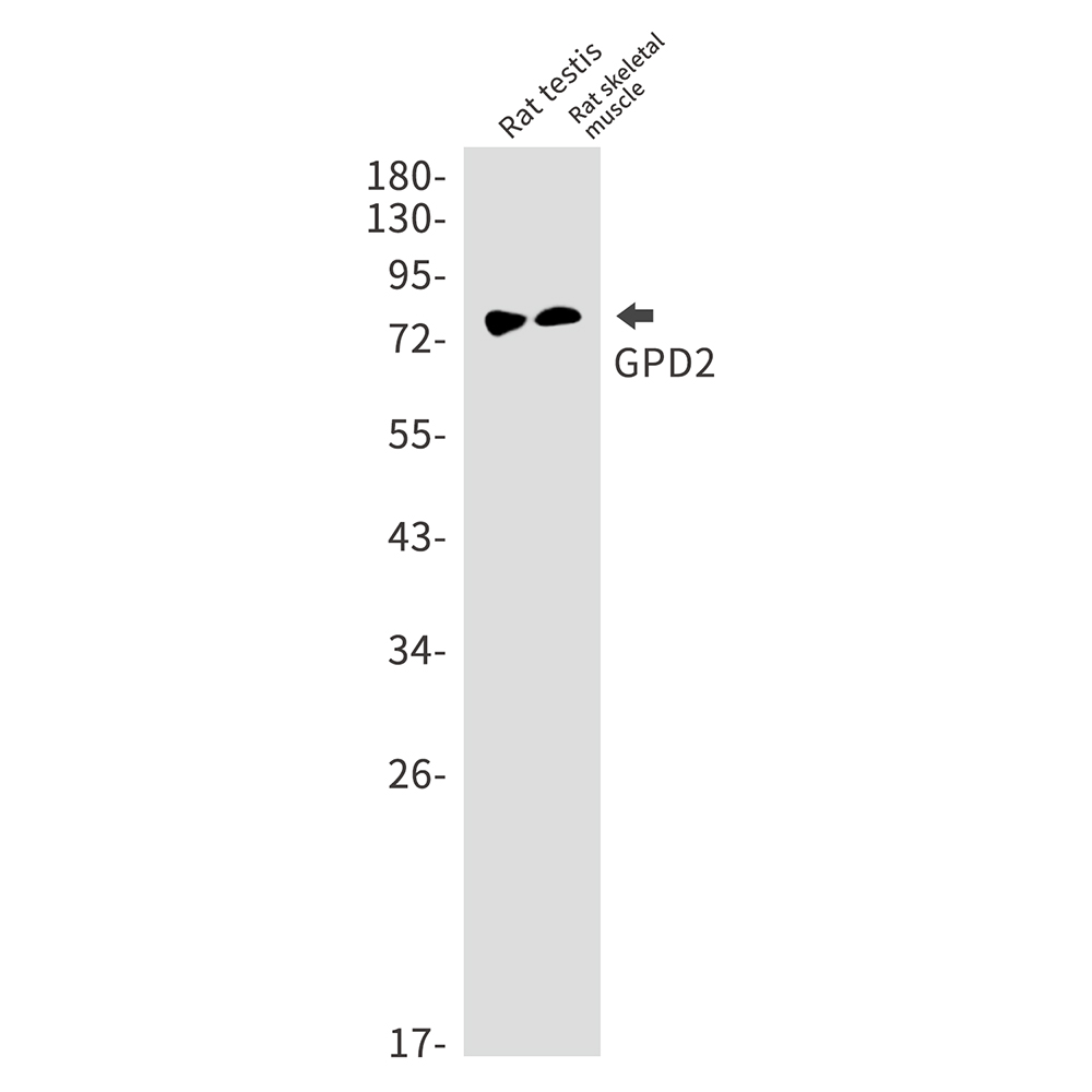 1 - GPD2 Rabbit mAb AP75515