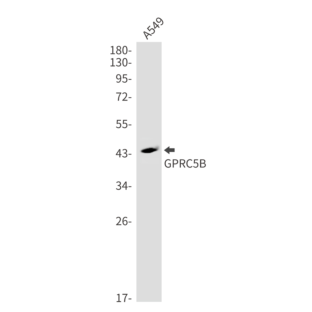 1 - GPRC5B Rabbit mAb AP75517