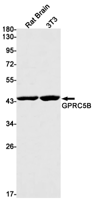 5 - GPRC5B Rabbit mAb AP75517