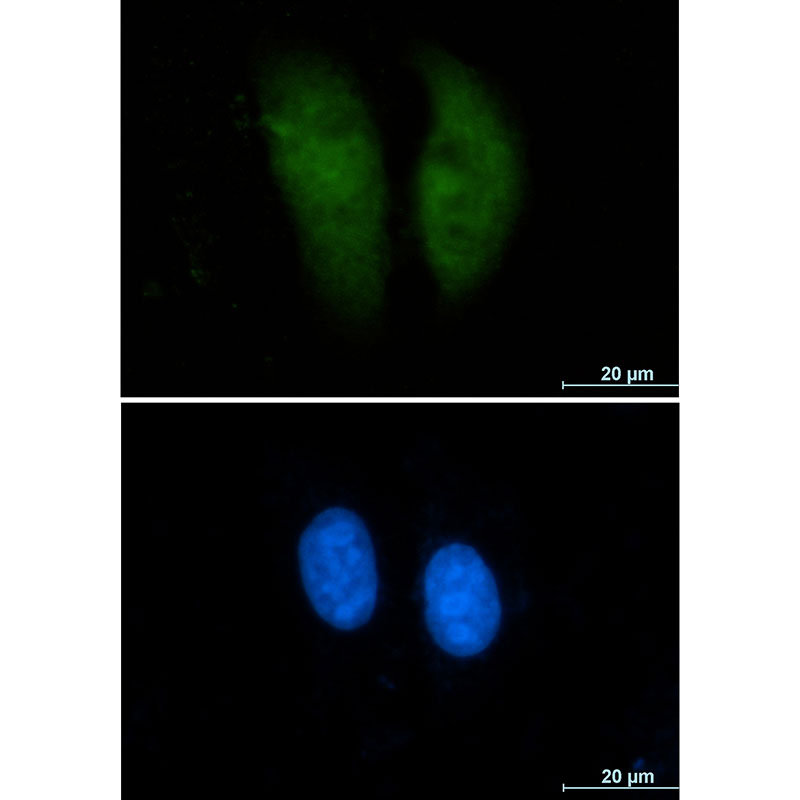 1 - GST3 / GST pi Rabbit mAb AP75521