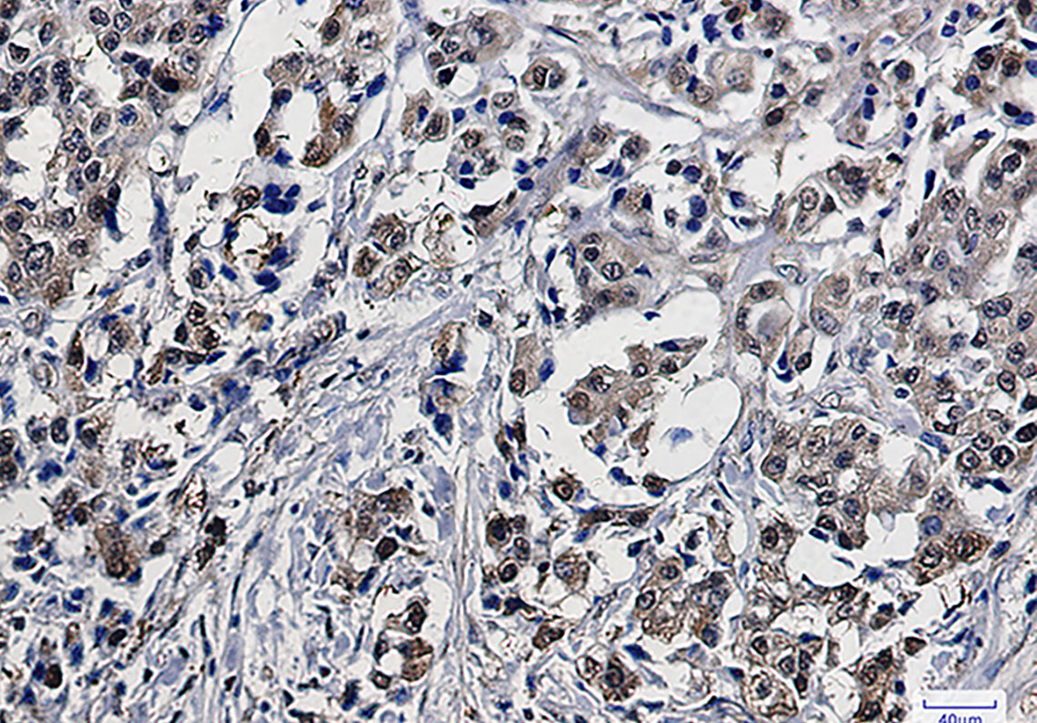 3 - GST3 / GST pi Rabbit mAb AP75521