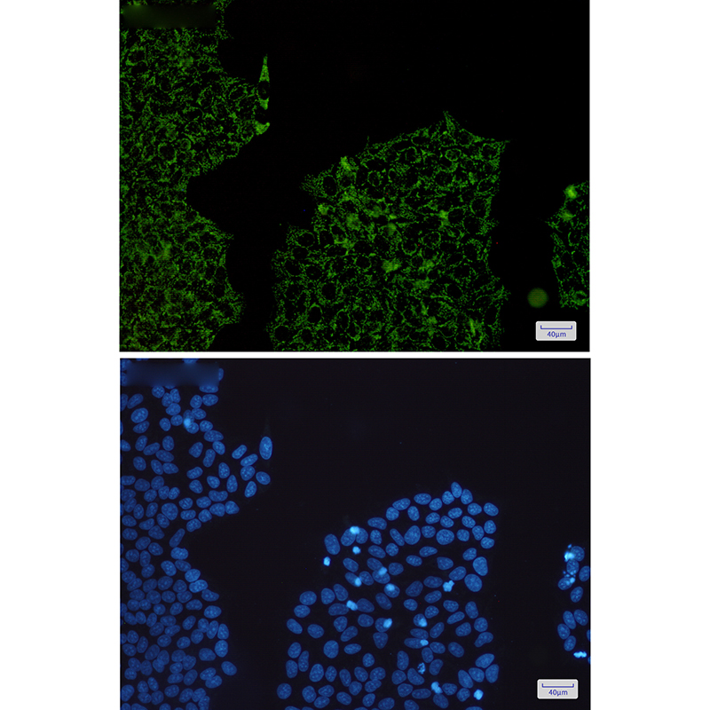 2 - HADHA Rabbit mAb AP75524