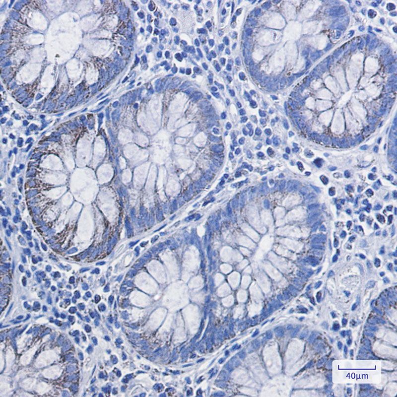 8 - HADHA Rabbit mAb AP75524