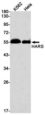 1 - HARS Rabbit mAb AP75526