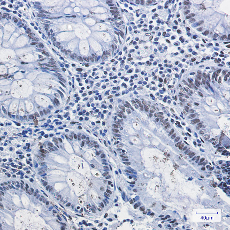8 - HDAC2 Rabbit mAb AP75531